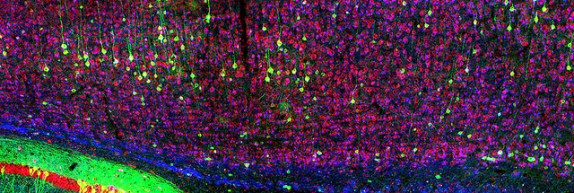 Image of brain activity, which links to IMFAR 2017 meeting page